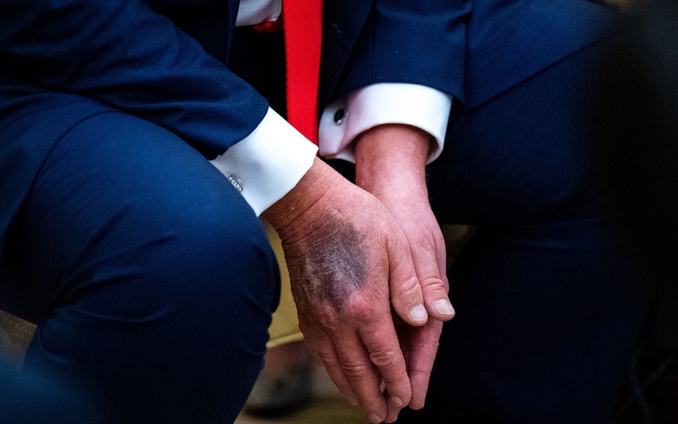 Rumeurs de mort : Donald Trump réapparaît et met fin à la frénésie en ligne 2 Trump 1