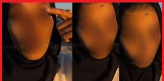 Casablanca : un homme interpellé après une agression ayant causé une infirmité permanente Casablanca : un homme interpellé après une agression ayant causé une infirmité permanente